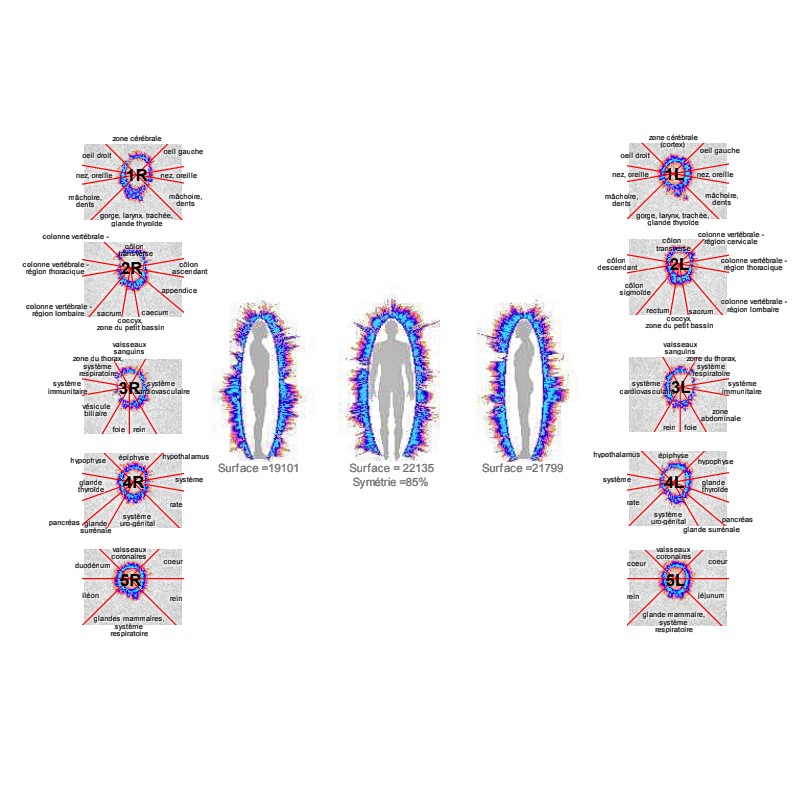 kirlian