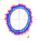 kirlian