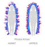 kirlian
